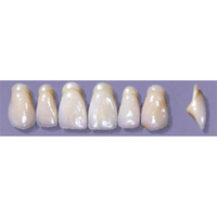 MYERSON ANTERIORS #A13/G (1x6 CARD) Card