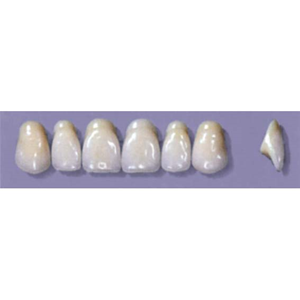 MYERSON ANTERIORS #A72/E (1x6 CARD) Card