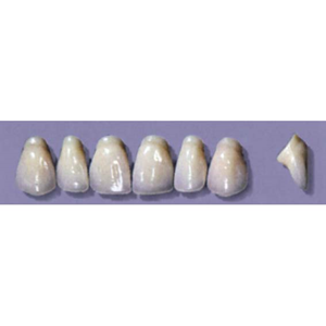 Myerson Anteriors #PW2/58 (1 x 6 Card), Each