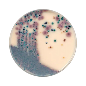 Prepared Plated Media, Chromogenic Candida (OCCA) Agar Plates, 10 Pieces/Pack Pack
